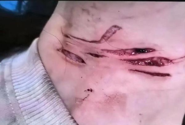 梦到别人脖子被割流血_周公解梦