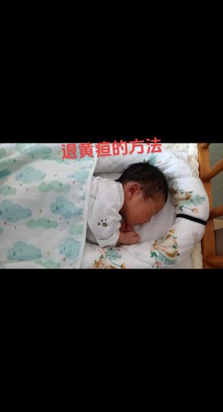 宝宝晒黄疸晒哪个部位_新生儿黄疸晒太阳正确方法