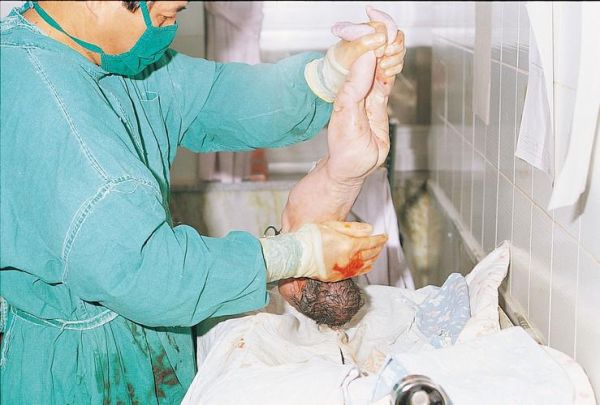 生孩子图片大全_孕妇分娩真实过程图解