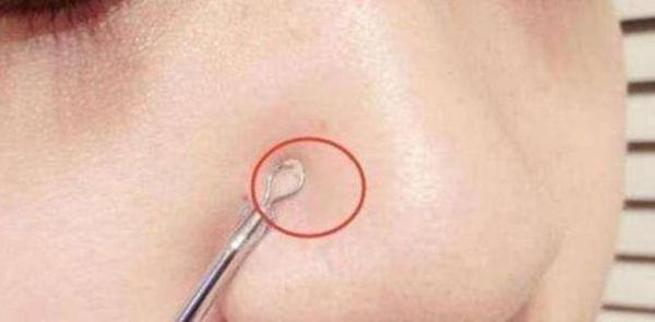 女宝宝分泌物正常吗_女宝宝有白色分泌物怎么办