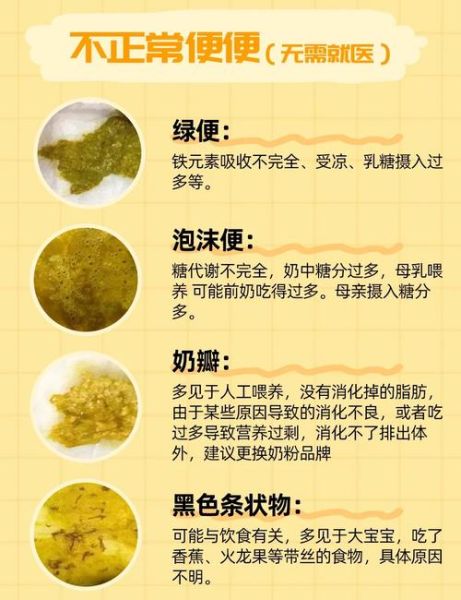 宝宝拉绿色粑粑怎么办_新生儿绿便正常吗