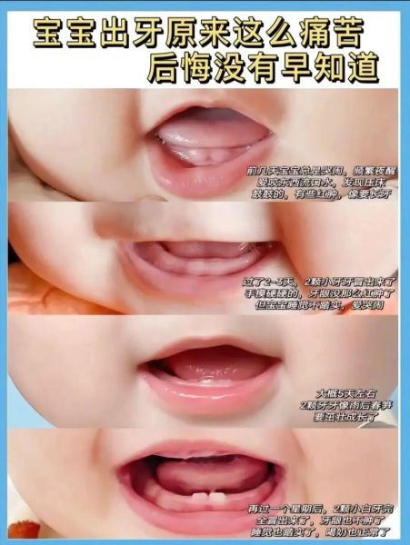 宝宝咬人是什么原因_如何纠正