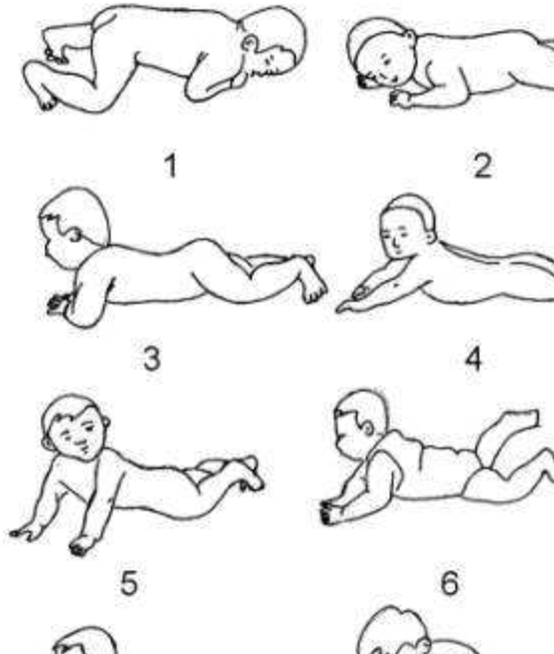 宝宝肌张力低是脑瘫吗_肌张力低与脑瘫区别