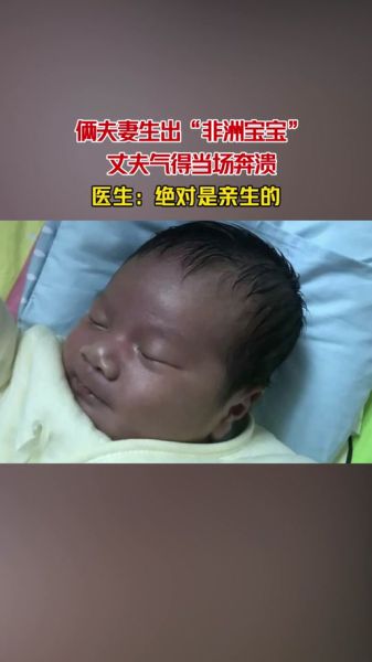 黑宝宝会变红满身是孔_怎么回事