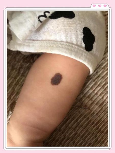 黑宝宝会变红满身是孔_怎么回事