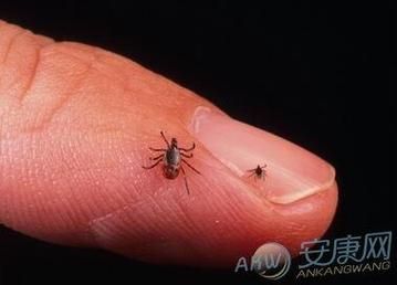 梦到身上有虫子_周公解梦准吗