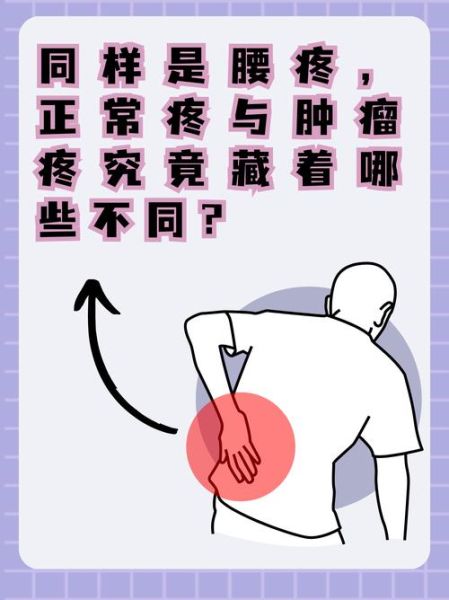 腰疼的位置图片大全_不同部位腰痛代表什么病