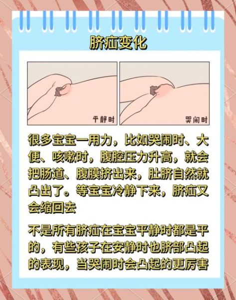 一岁半宝宝疝气症状_需要手术吗