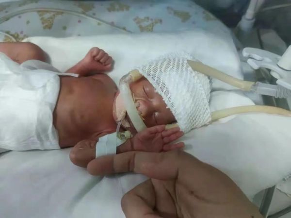 怀孕29周宝宝有多重_29周胎儿体重正常范围