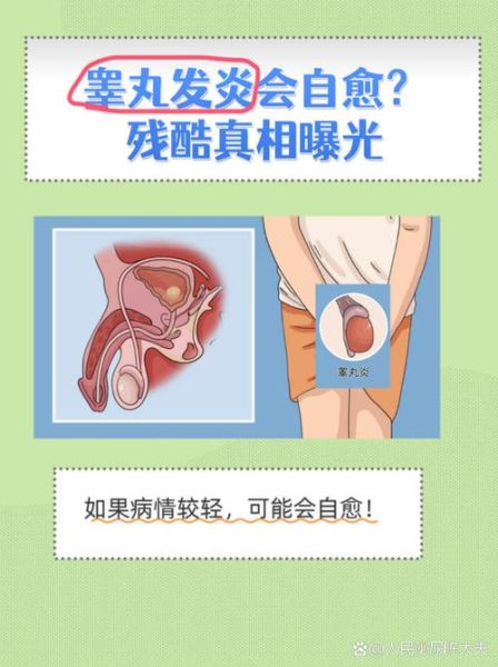 宝宝睾丸炎图片_宝宝睾丸炎症状有哪些