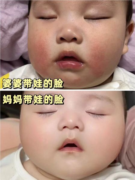 宝宝两个脸蛋发红怎么回事_婴儿脸红发热的原因