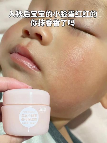 宝宝两个脸蛋发红怎么回事_婴儿脸红发热的原因
