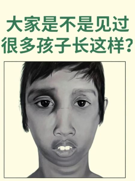 宝宝总是张着嘴_会影响发育吗