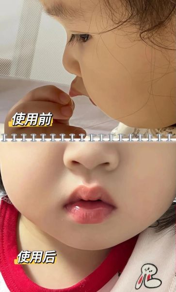 宝宝嘴唇上翘正常吗_宝宝嘴唇上翘怎么办