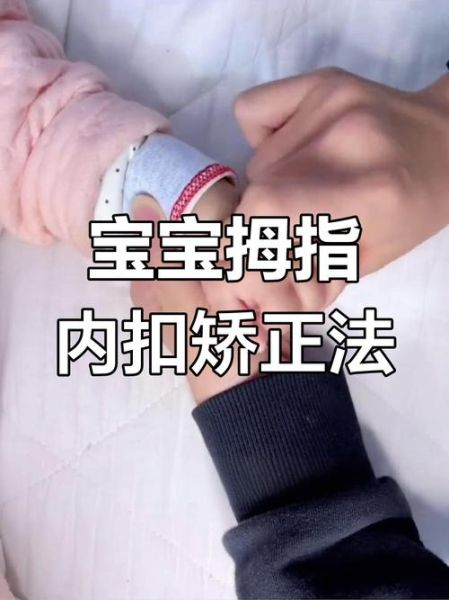 四个月宝宝拇指内扣正常吗_如何纠正